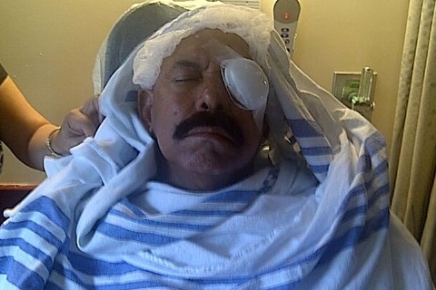 Oscar De Len casi pierde un ojo tras accidente