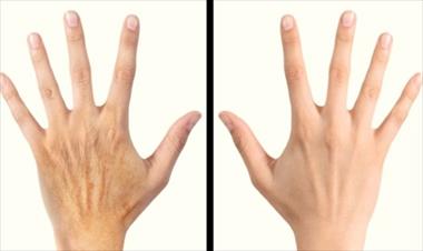 /vidasocial/haz-que-tus-manos-luzcan-mas-jovenes-con-estos-trucos/55435.html